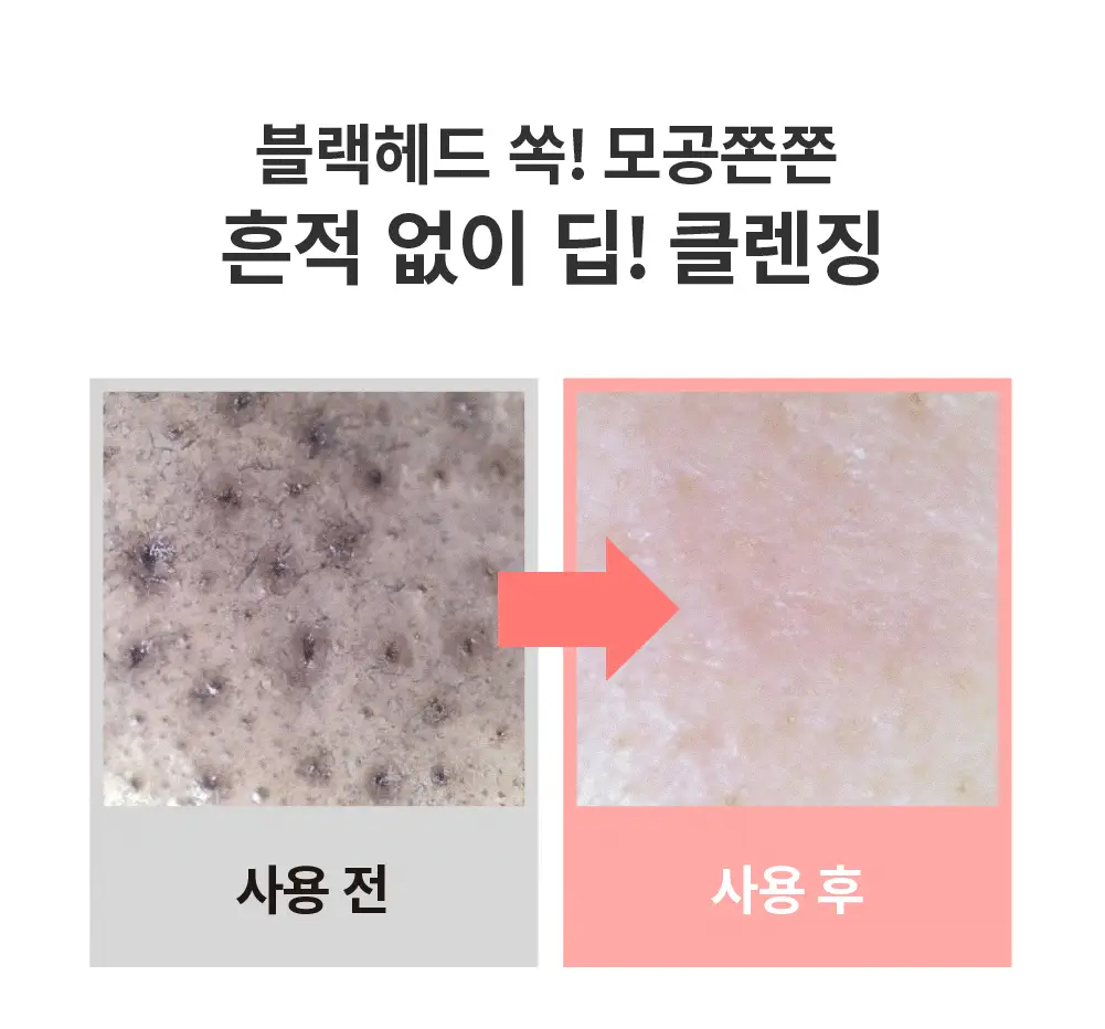 [메이크업순싹/쫀득백설기밤] 에스네이처 아쿠아 라이스 클렌징밤 90ml 상세페이지 21